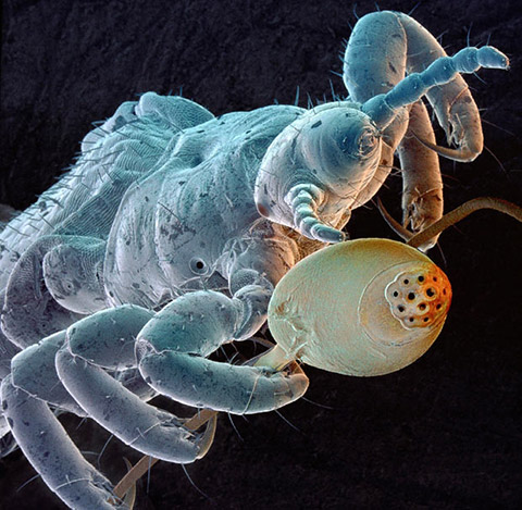 An enhanced close up image of an insect